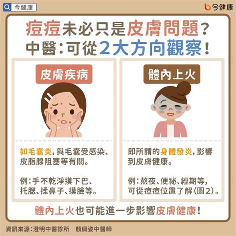 痘痘長得位置|青春痘、下巴痘痘長這個位置代表什麼意思？先弄懂長。